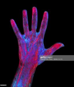 Xray photo of veins in a hand